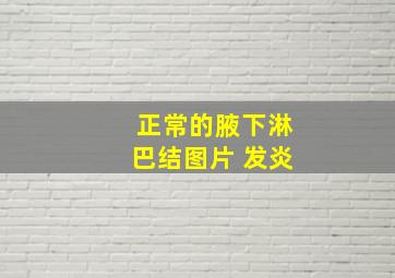 正常的腋下淋巴结图片 发炎